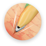 Ponta sem lâmina em duplo V